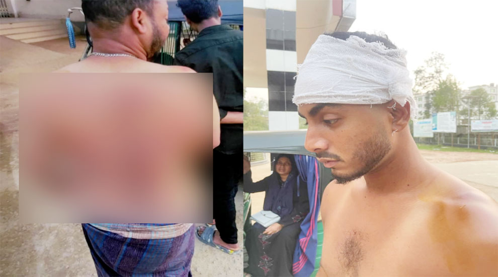 বড়লেখায় ভাগ্নেসহ প্রবাসীর ওপর হামলা, মামলা তুলে নিতে হুমকির অভিযোগ