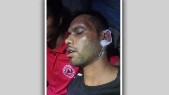 নবীগঞ্জে ব্যবসা-প্রতিষ্ঠানে হামলা