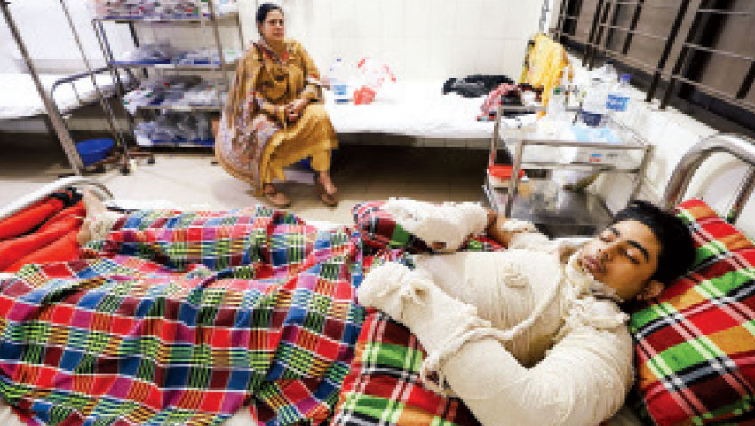 পোড়া হাতের ইশারাই ভরসা তাদের