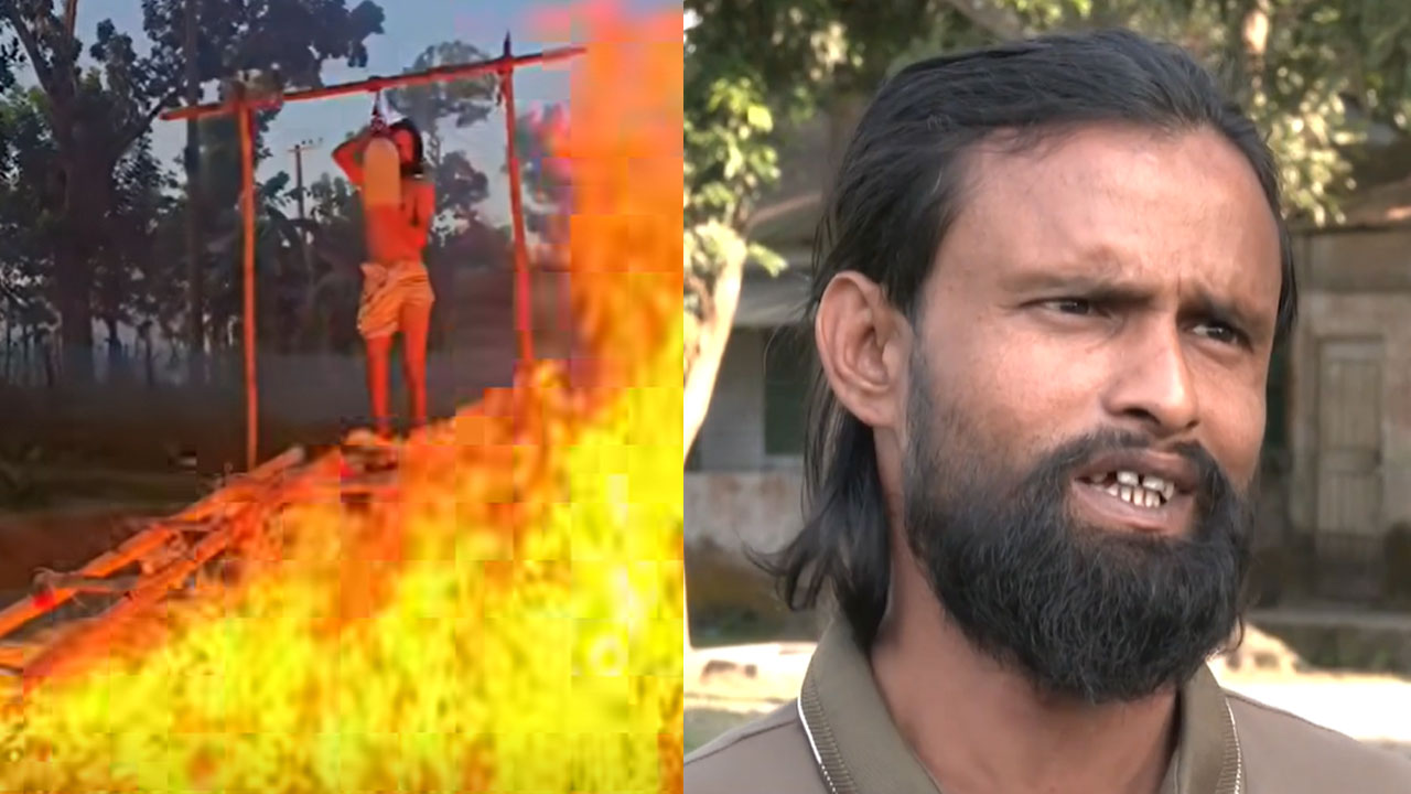 আগুন জ্বালিয়ে কন্টেন্ট তৈরি করতে গিয়ে আল-আমিন দগ্ধ