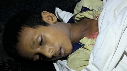 বিয়ানীবাজারে বন্ধুর ছুরির আঘাতে কিশোর খুন