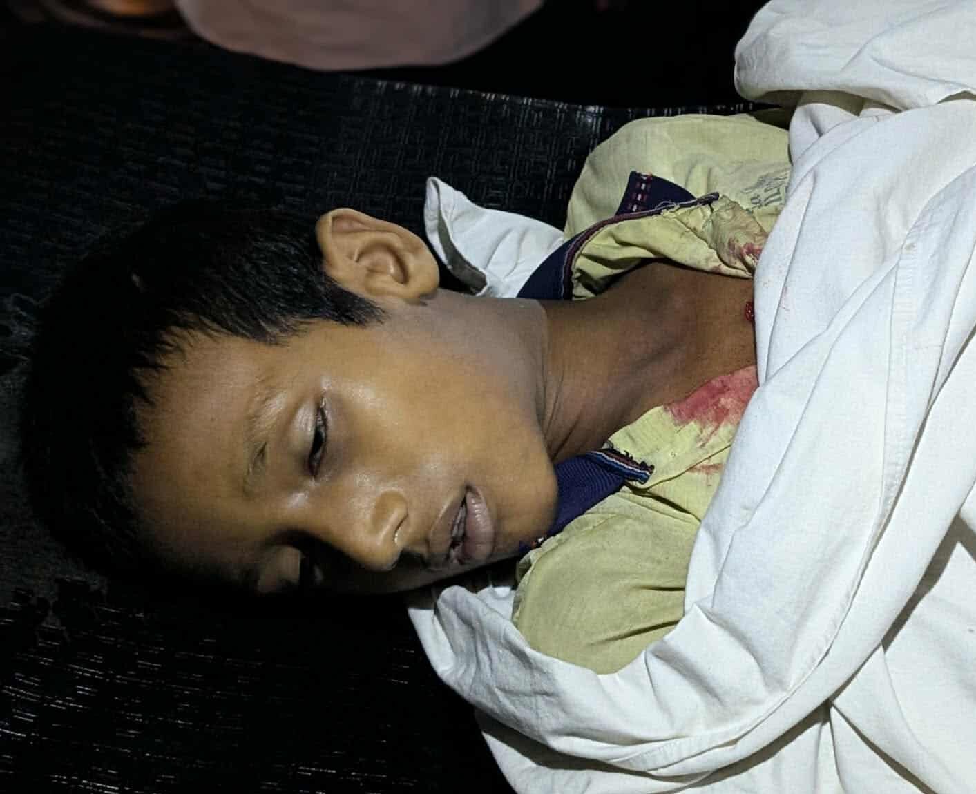 বিয়ানীবাজারে বন্ধুর ছুরির আঘাতে কিশোর খুন