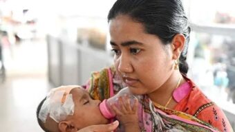 সিলেটে হামে আরও তিন শিশুর মৃত্যু